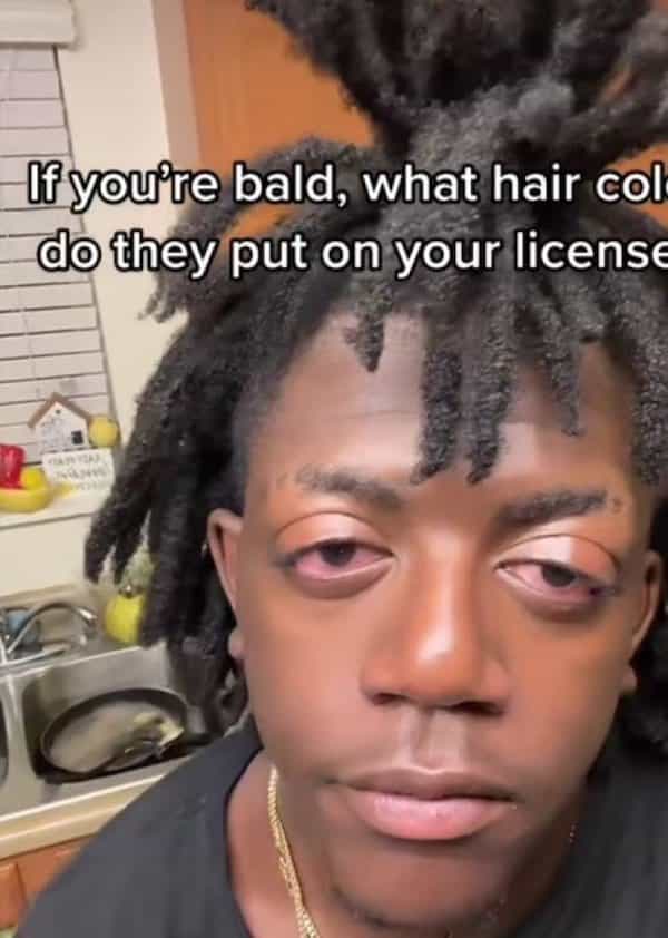 If you'te bald, what hair col do they put on your license