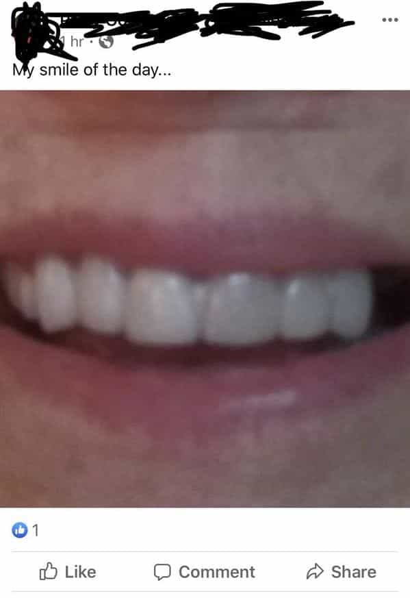 My smile of the day.just teeth