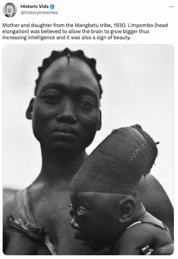 Mother and daughter from the Mangbetu tribe, 1930. Limpombo (head elongation) was believed to allow the brain to grow bigger thus increasing intelligence and it was also a sign of beauty.