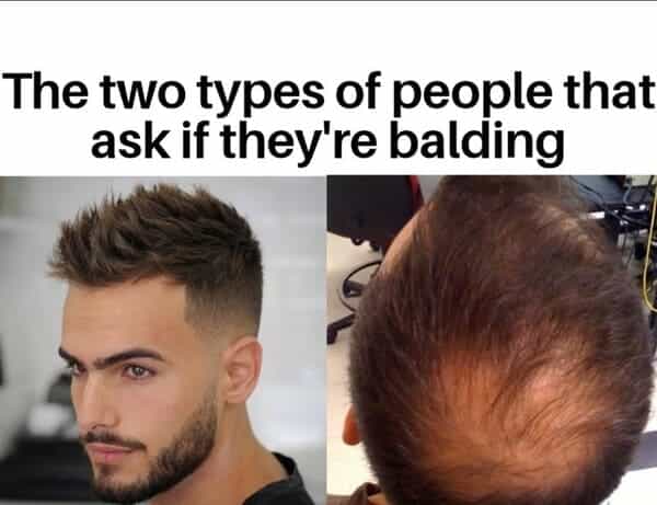 The two types of people that ask if they're balding