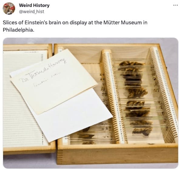 weird history facts Slices of Einstein's brain on display at the Mütter Museum in Philadelphia.