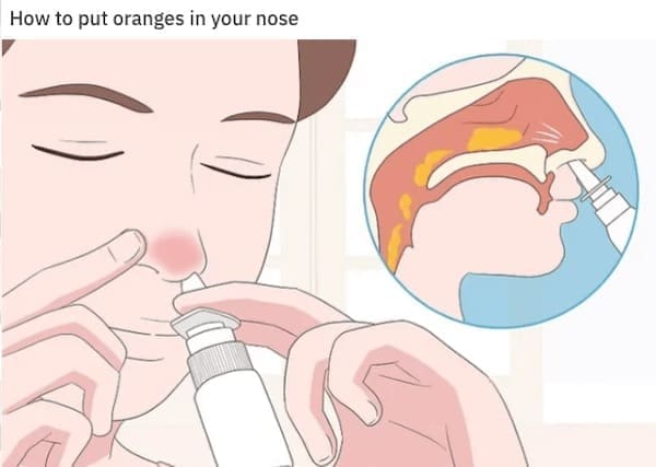 wiki how memes How to put oranges in your nose