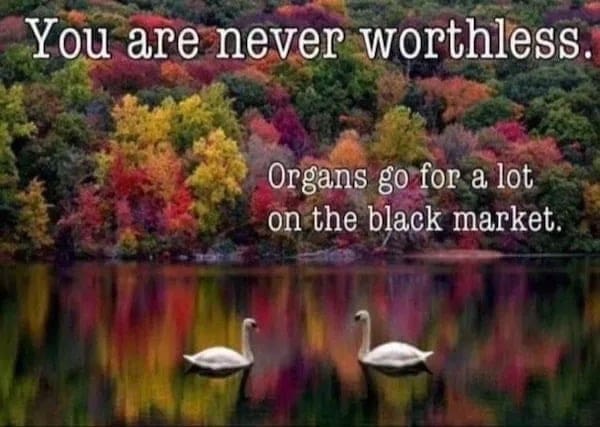 funny pics You are never worthless. Organs go for a lot on the black market.