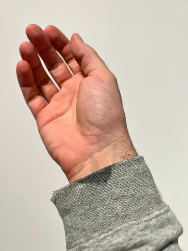 mildly annoying things, visual agitation