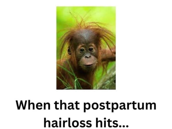 New parent memes When that postpartum hairloss hits...