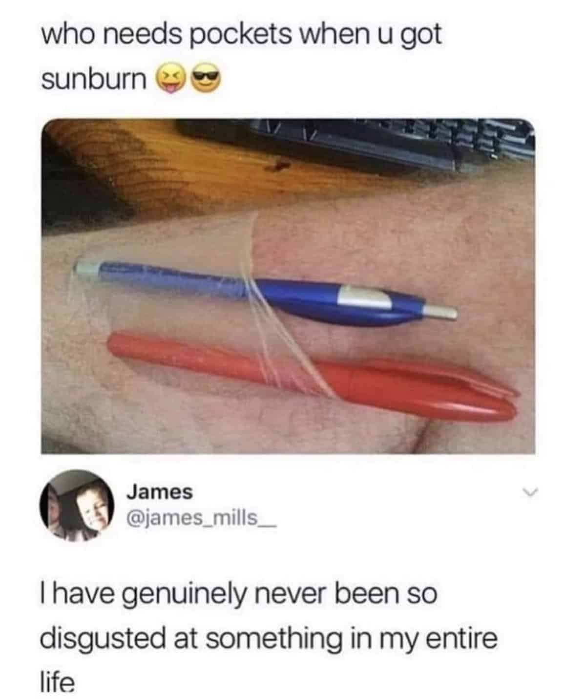 who needs pockets when u got sunburn