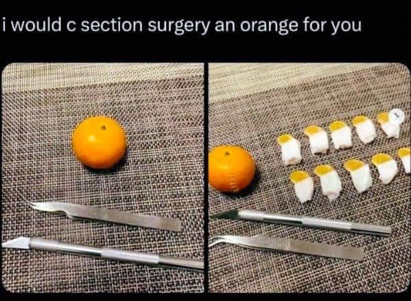 i would c section surgery an orange for you