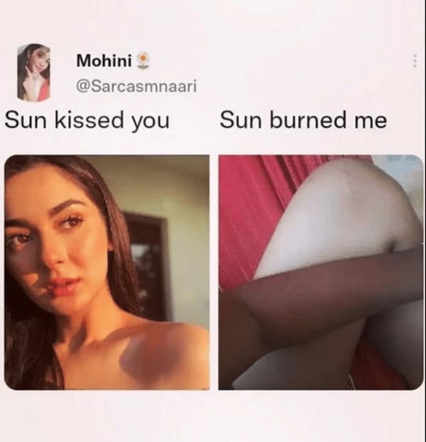 bad sunburn memes. Sun kissed you Sun burned me
