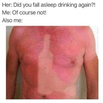 bad sunburn memes. Her: Did you fall asleep drinking again?! Me: Of course not! Also me: