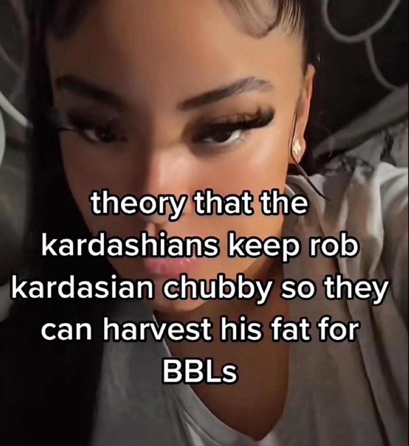 funny memes. theory that the kardashians keep rob kardasian chubby so they can harvest his fat for BBLS