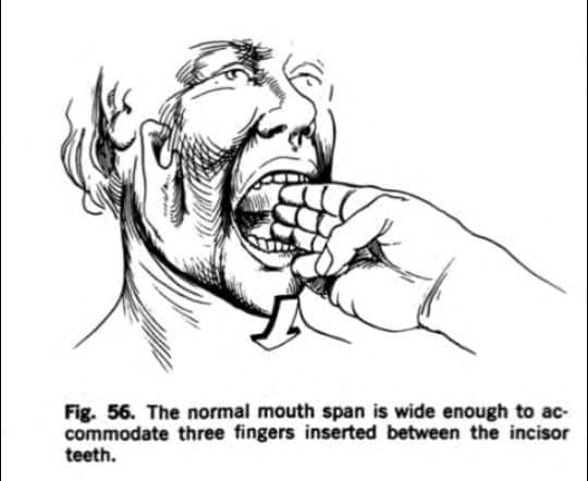 Fig. 56. The normal mouth span is wide enough to accommodate three fingers inserted between the incisor teeth.