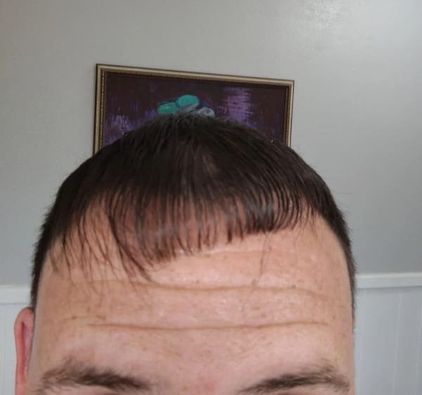 bad haircuts, terrible haircuts, haircut disasters, hair fails, awful haircuts, cringe-worthy haircuts, haircut mistakes