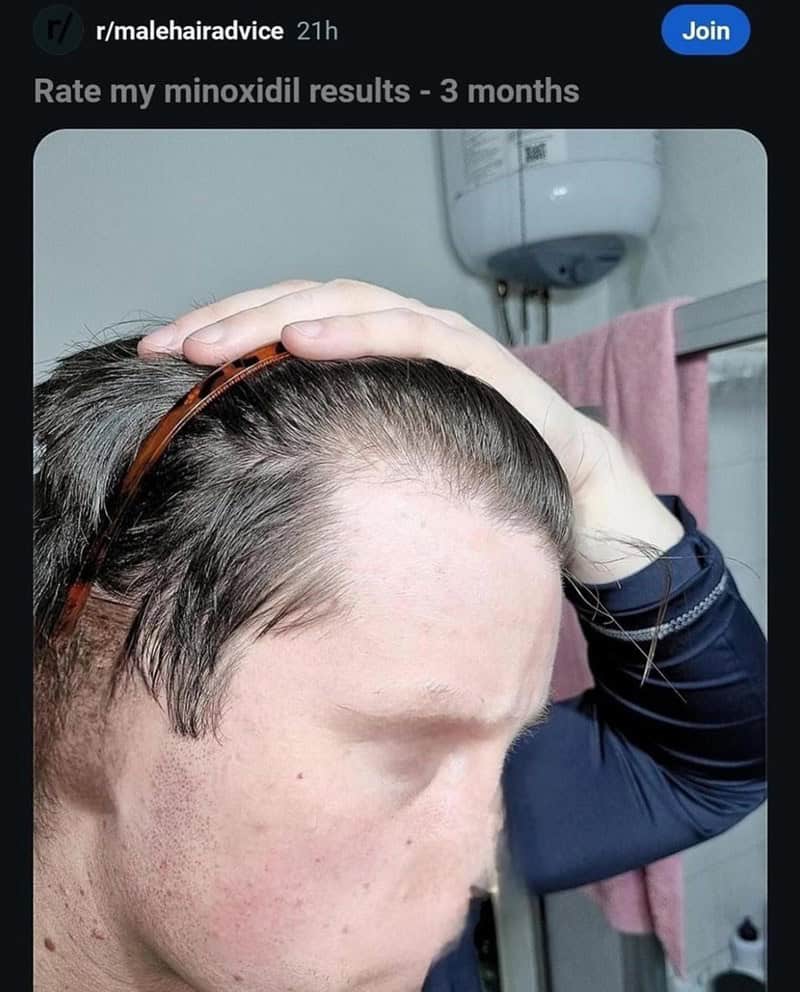 funny reddit posts, funny reddits, Hilarious Reddit content, Weird Reddit, Reddit finds