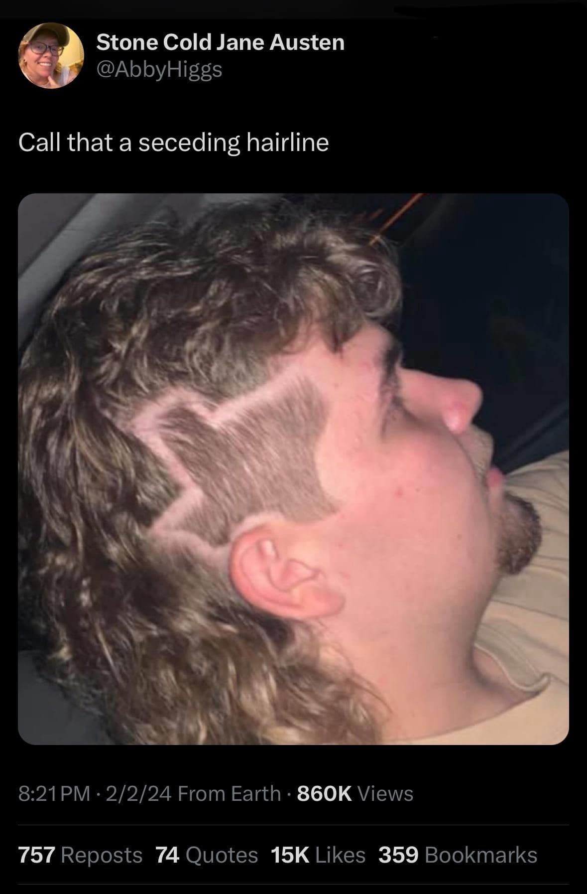 Call that a seceding hairline