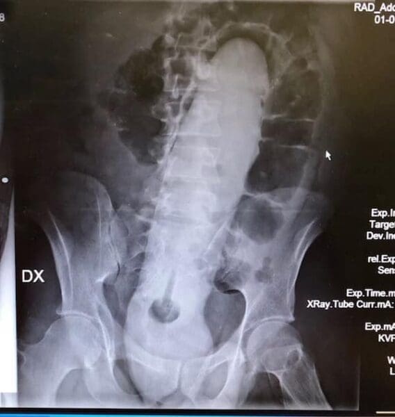 Stuck Up X Rays 31 Weird X-Ray Photos That (Yes) They Really Are Real