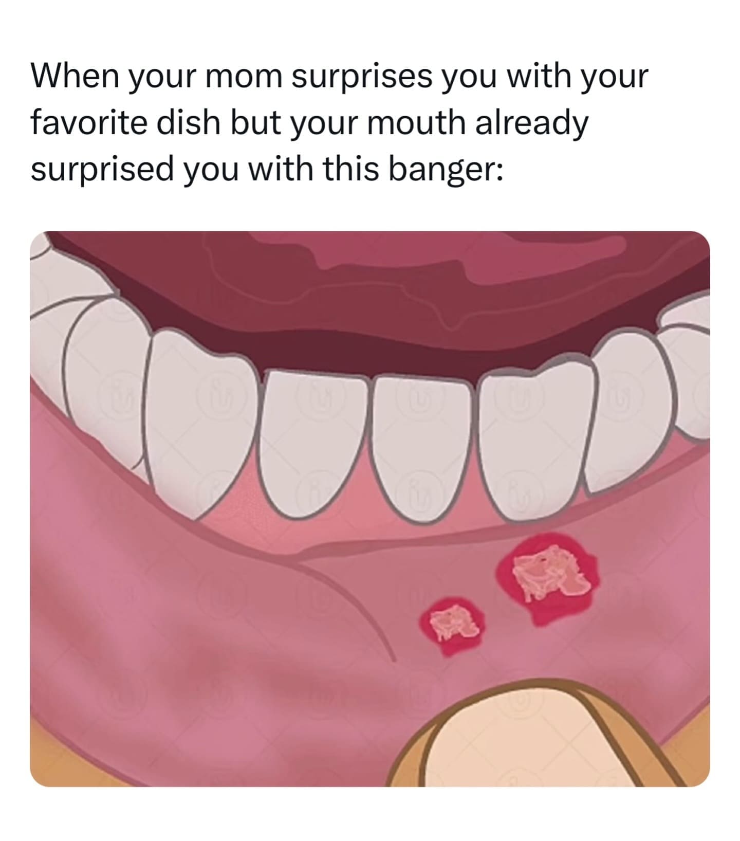 When your mom surprises you with your favorite dish but your mouth already surprised you with this banger: