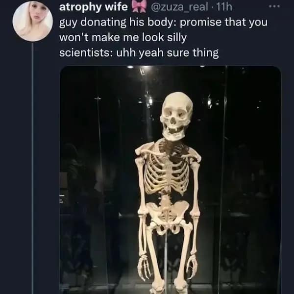 atrophy wife &* @zuza real • 11h guy donating his body: promise that you won't make me look silly scientists: uhh yeah sure thing