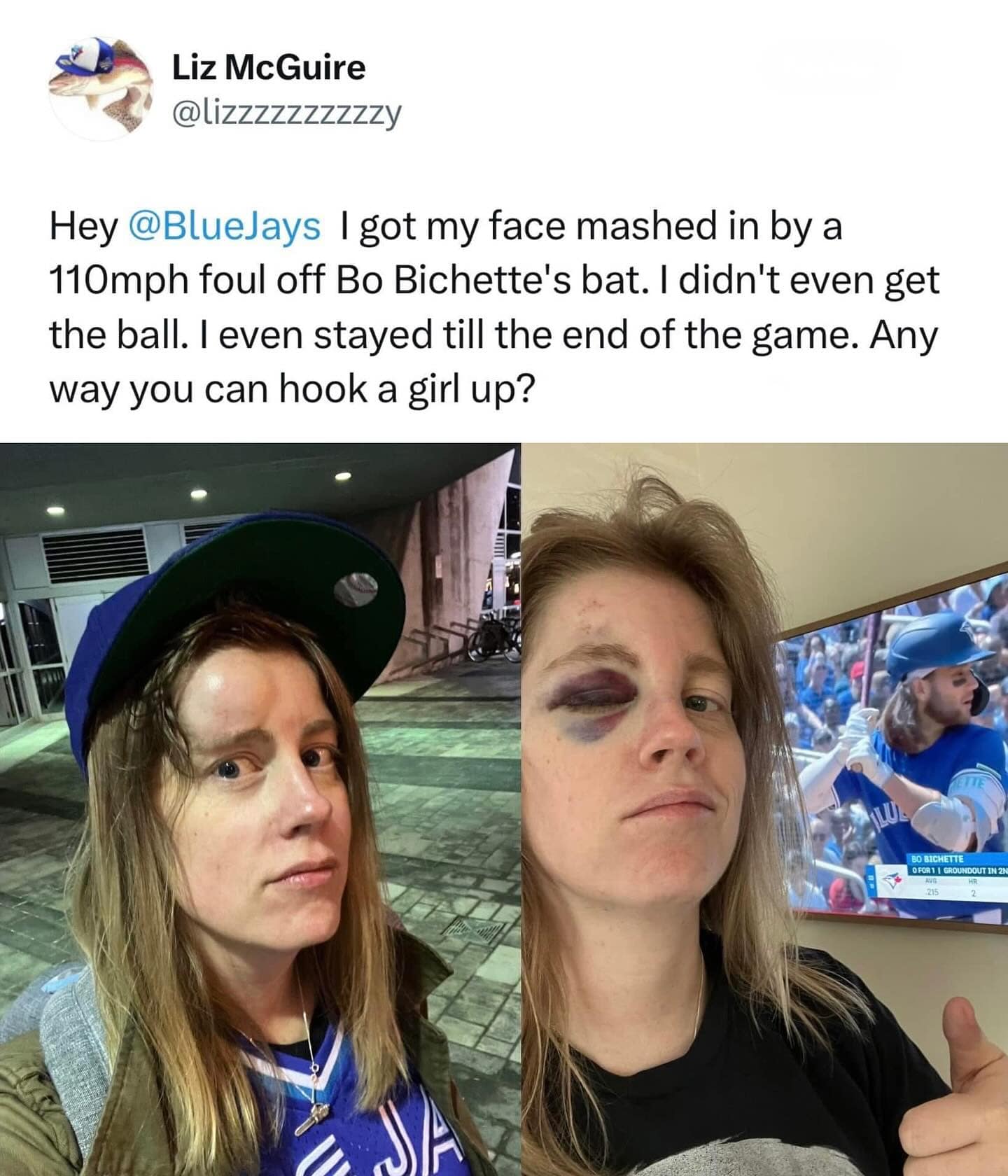 Liz McGuire @lizzzzzzzzzzy Hey @BlueJays I got my face mashed in by a 110mph foul off Bo Bichette's bat. I didn't even get the ball. I even stayed till the end of the game. Any way you can hook a girl up? BOI ВІСНЕТТЕ