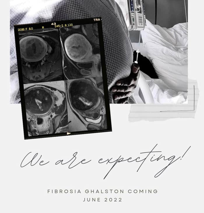 We are expecting FIBROSIA GHALSTON COMING