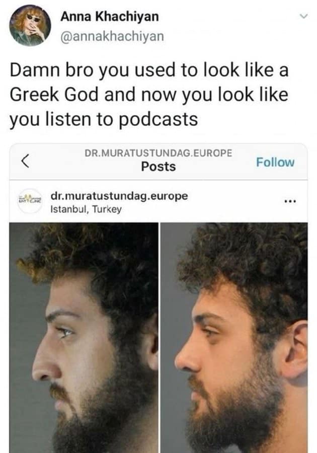 A funny tweet roasting a man's nose job by saying he now "looks like he listens to podcasts."