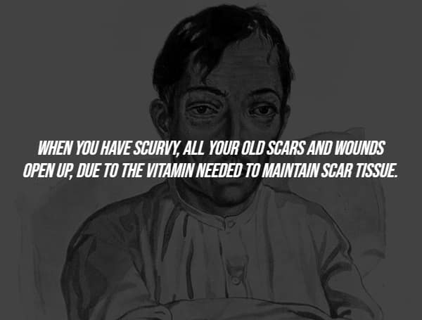 Sickly man illustration with fact about scurvy reopening scars