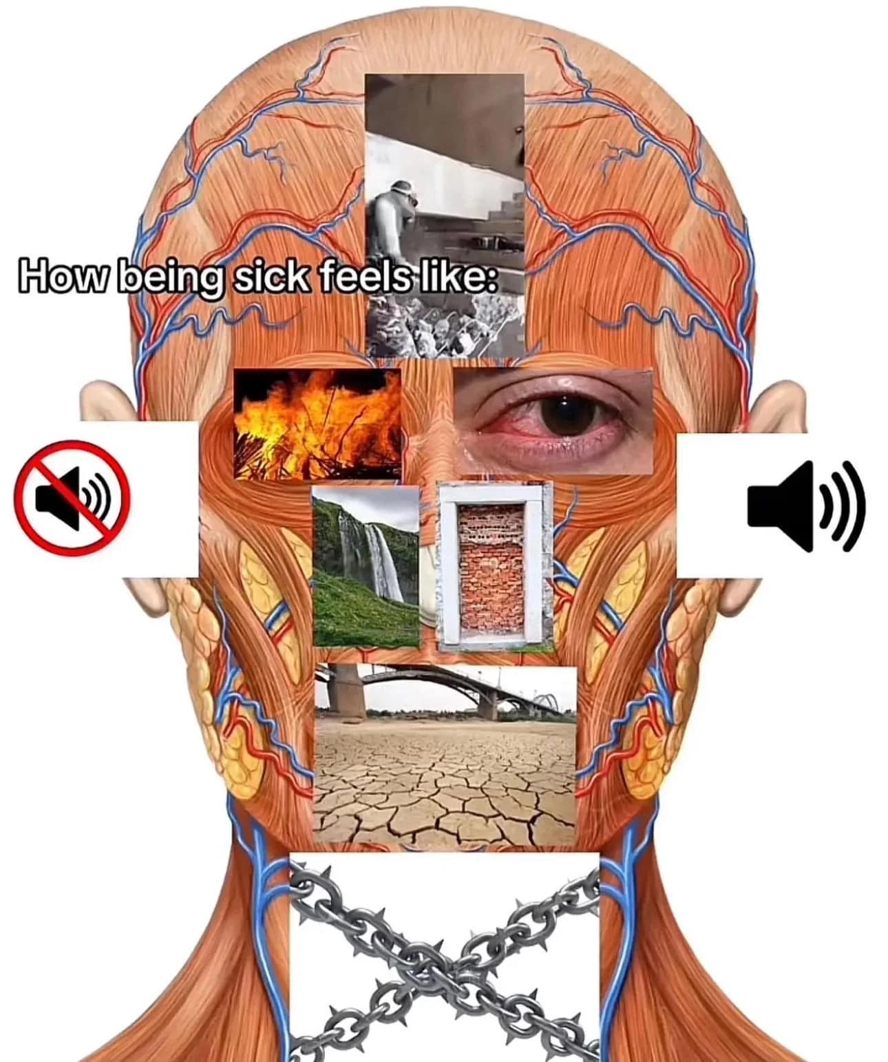 A funny meme and surreal diagram that accurately describes all the symptoms of being sick.