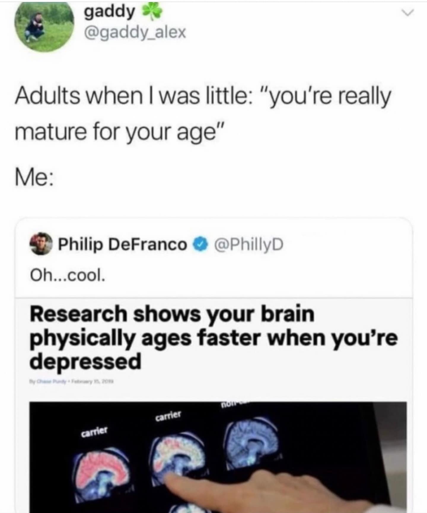 A relatable meme connecting being "mature for your age" with depression causing accelerated brain aging.