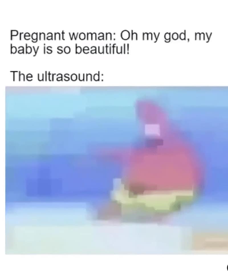 Very pixelated blurry cartoon image used as a stand-in for an ultrasound photo.