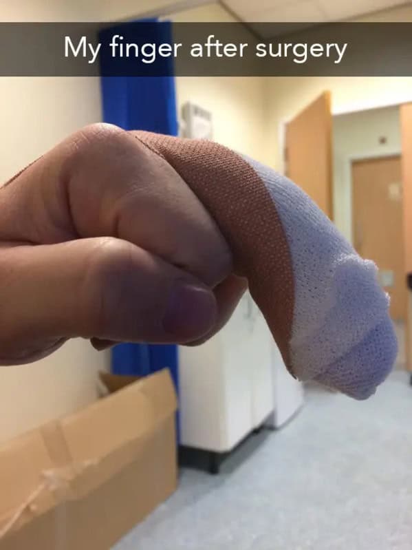 A funny but slightly graphic photo of a person's heavily bandaged index finger after they have had surgery, which now looks very large and comically phallic.