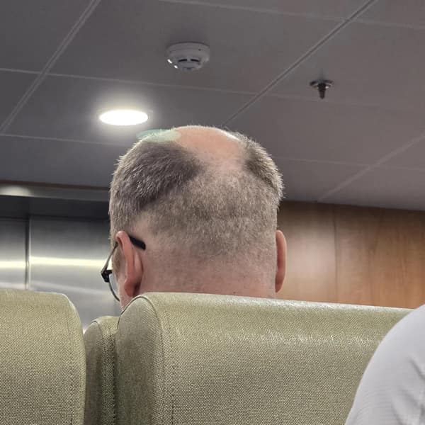 Back of a balding man’s head on a ferry, thin ring of hair with a bare crown under bright ceiling lights.
