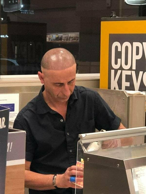 A man with one of the worst haircut fails, a bald head with a harsh, spray-on tan line.