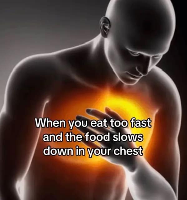 A funny pic of a medical diagram showing the burning pain of eating too fast.