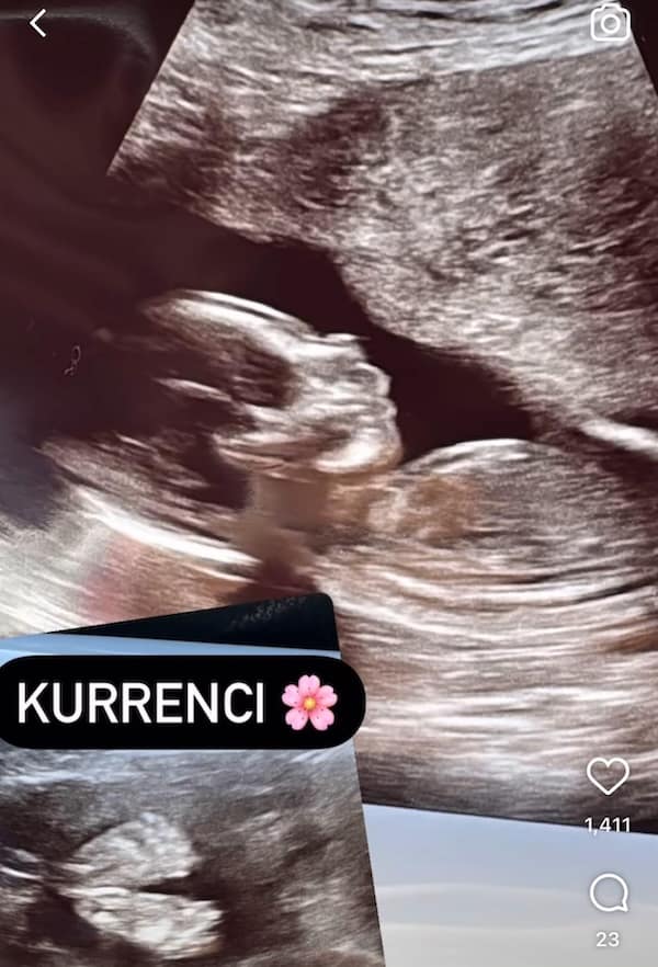 A baby's ultrasound photo with the unfortunate name "Kurrenci" written over it.
