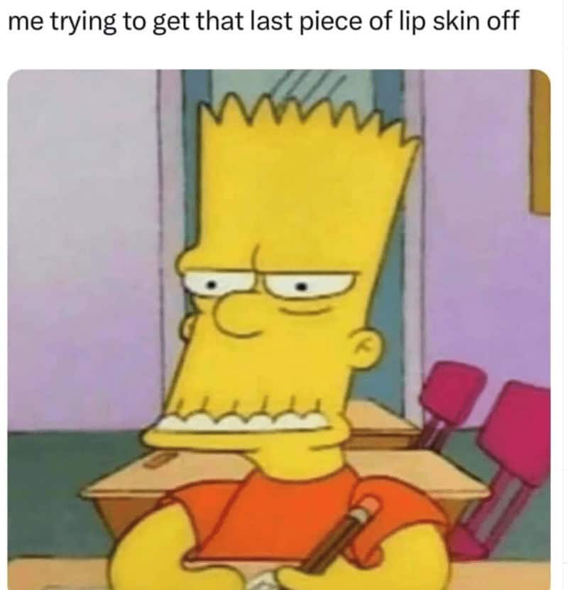 Bart Simpson with a chapped, jagged mouth captioned "me trying to get that last piece of lip skin off."