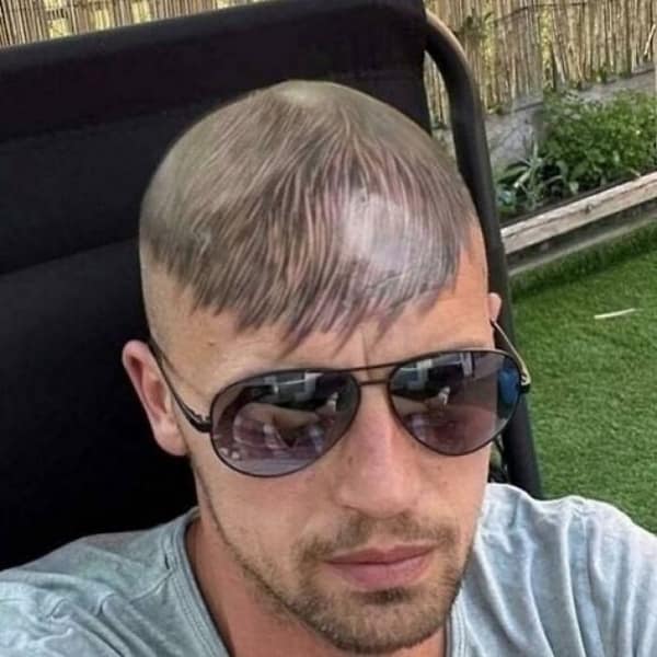Bald man with fake hair bangs tattooed onto his forehead to hide recession.