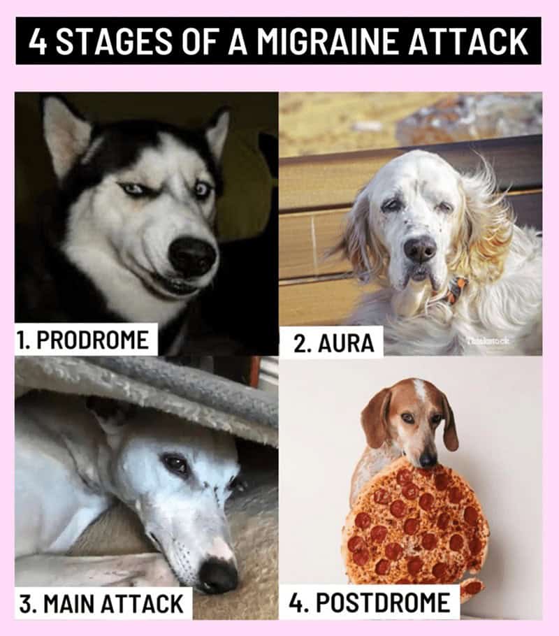 Funny migraine meme showing the "4 stages of a migraine attack" using four different dog pictures.