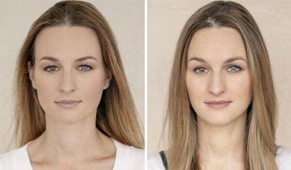 Woman with heterochromia different colored eyes in before and after pregnancy portrait split.