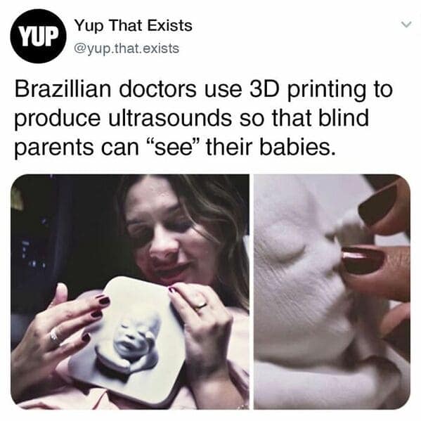 A fun random fact about Brazilian doctors using 3D printing to let blind parents feel ultrasounds.