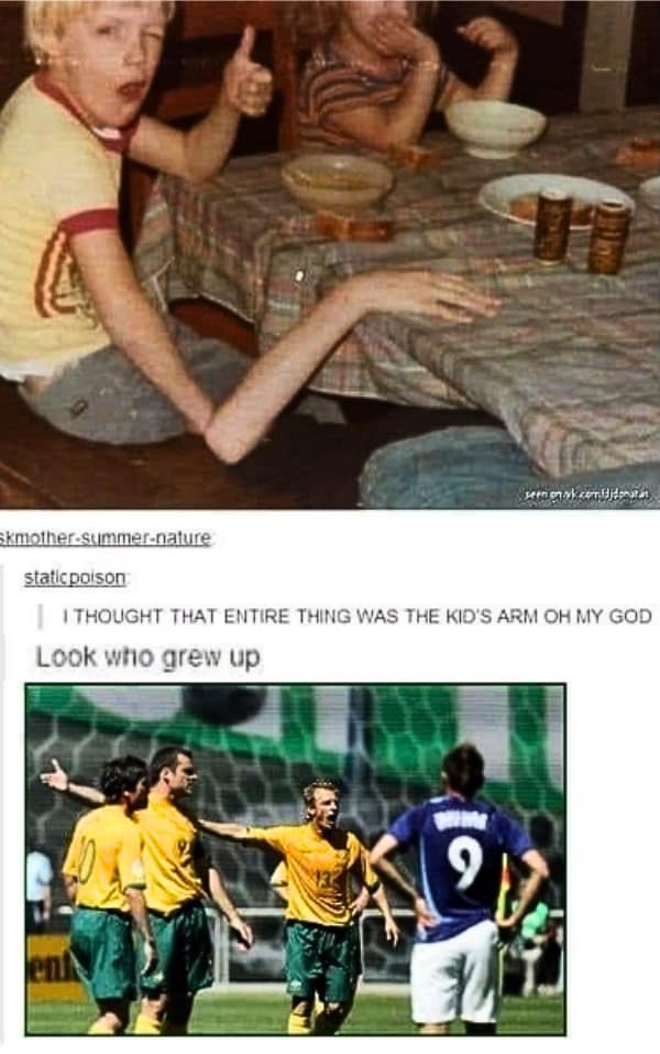 Confusing perspective photo of a boy appearing to have an extremely long arm next to soccer players.