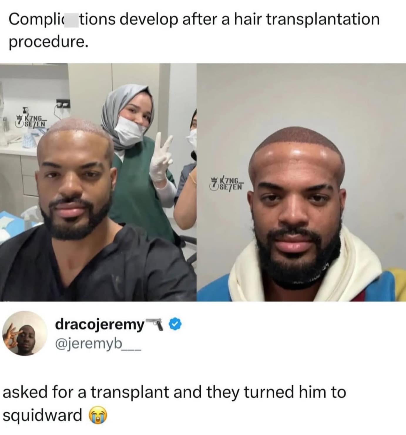 Man with swollen head after surgery compared to Squidward funny pics.