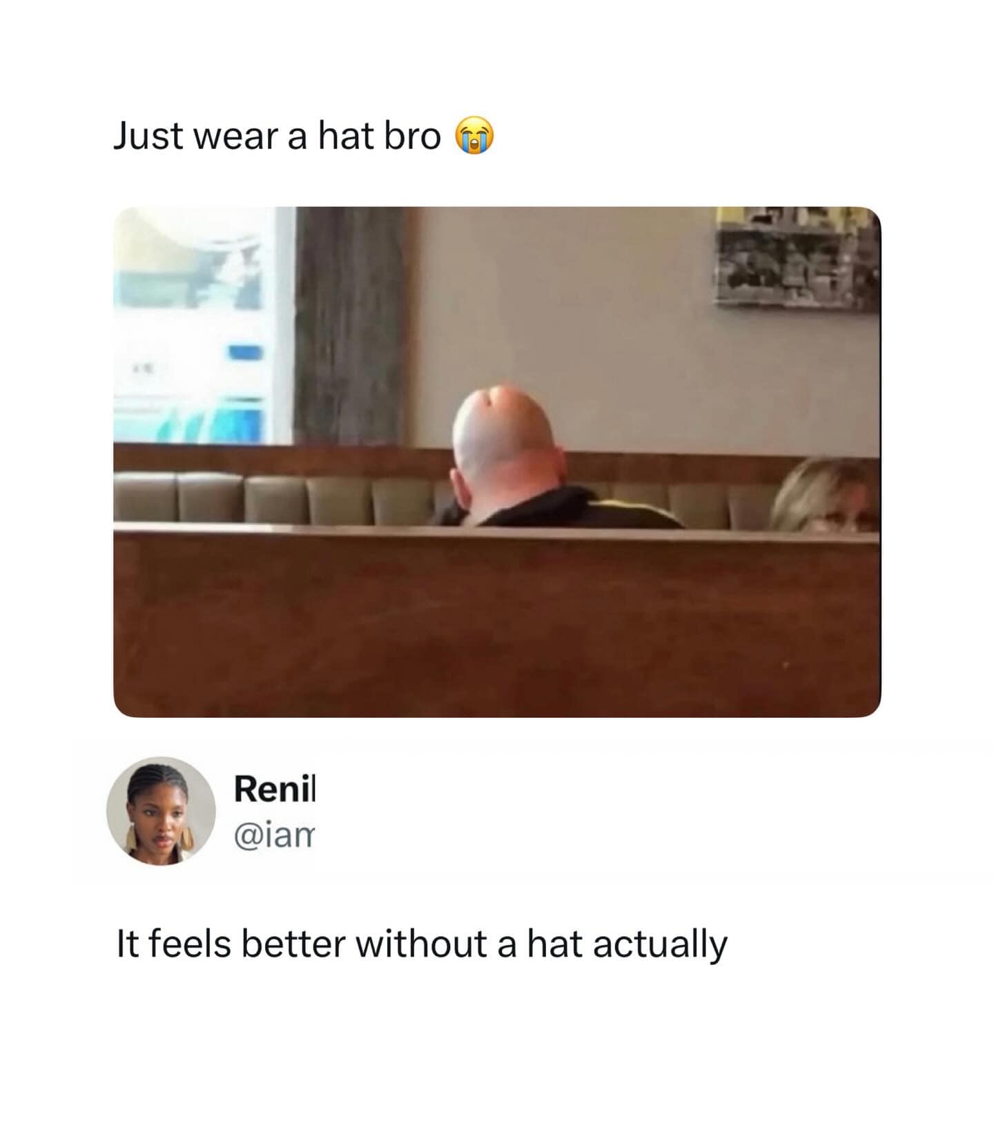 Bald man with a deep dent in his head sitting in a restaurant booth.