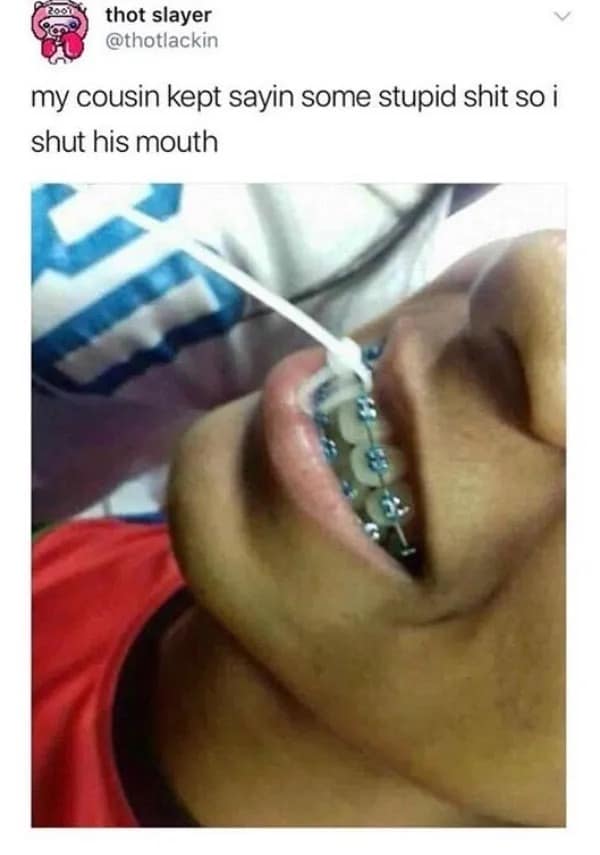 Person with braces having their mouth zipped shut with a plastic zip tie.