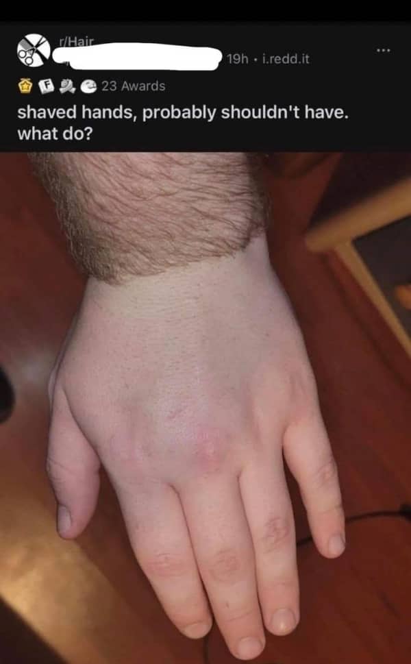 Photo of a person's hand with all the hair shaved off at the wrist line.