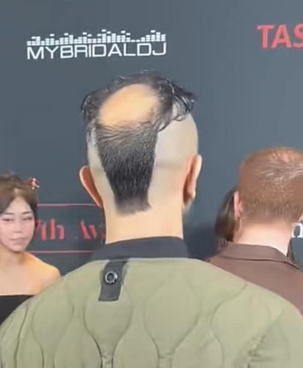 A back view of a balding head with a patch of hair left in the middle like a tail.