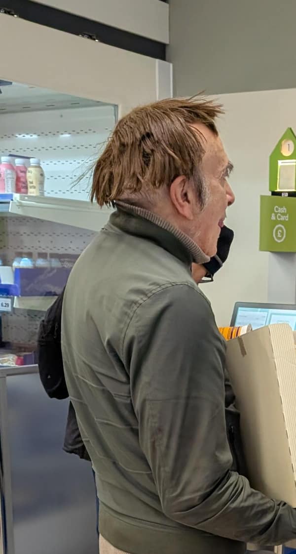 A side profile of a man with a messy bad haircut that looks like a detached toupee.