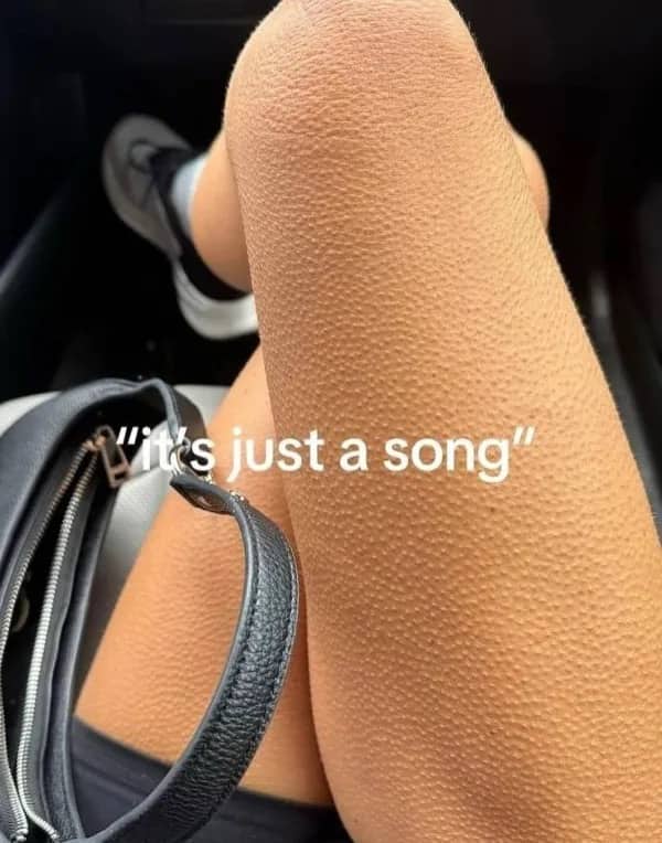 Leg covered in goosebumps while listening to music captioned "it's just a song".