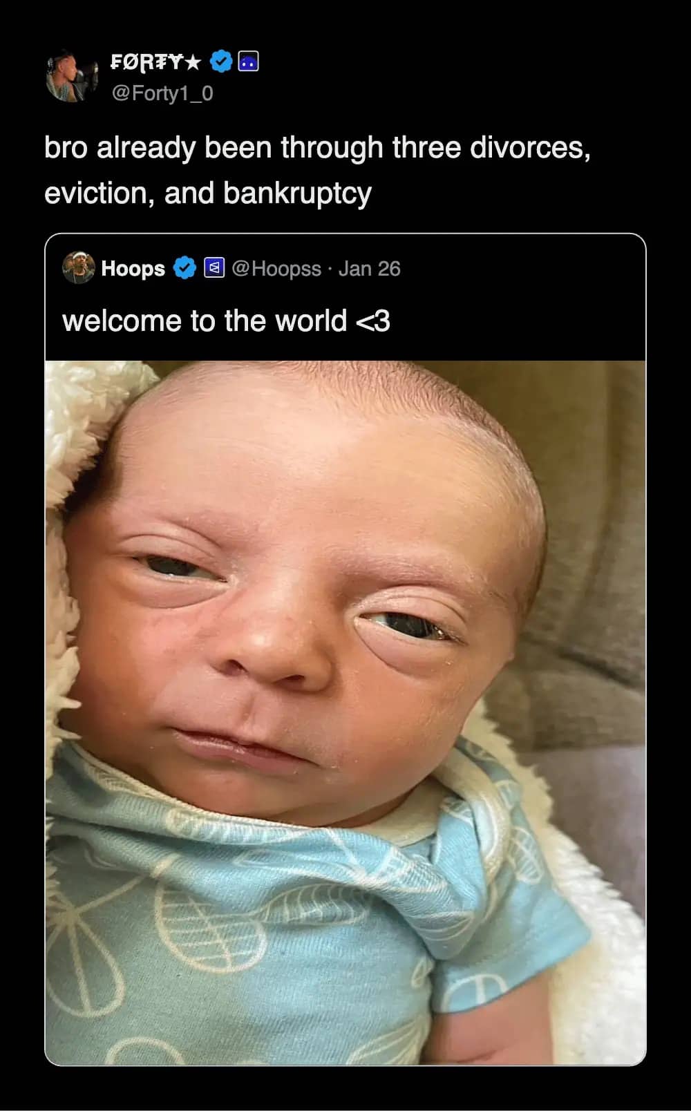 Newborn baby with wrinkled grumpy face looking like an old man meme.