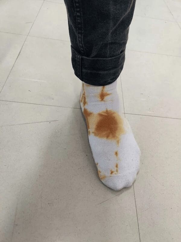 A white sock with brown tie-dye patterns that look like a bathroom accident, representing a major fashion faux pas.