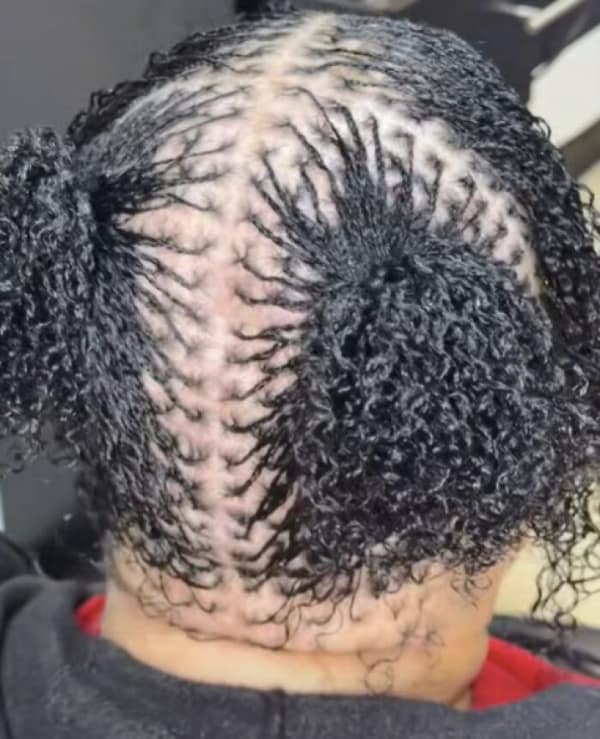 haircut fail showing the back of a person's head where extremely thin, sparse hair has been pulled tightly into tiny micro-twists and two small buns, exposing large patches of bare scalp.