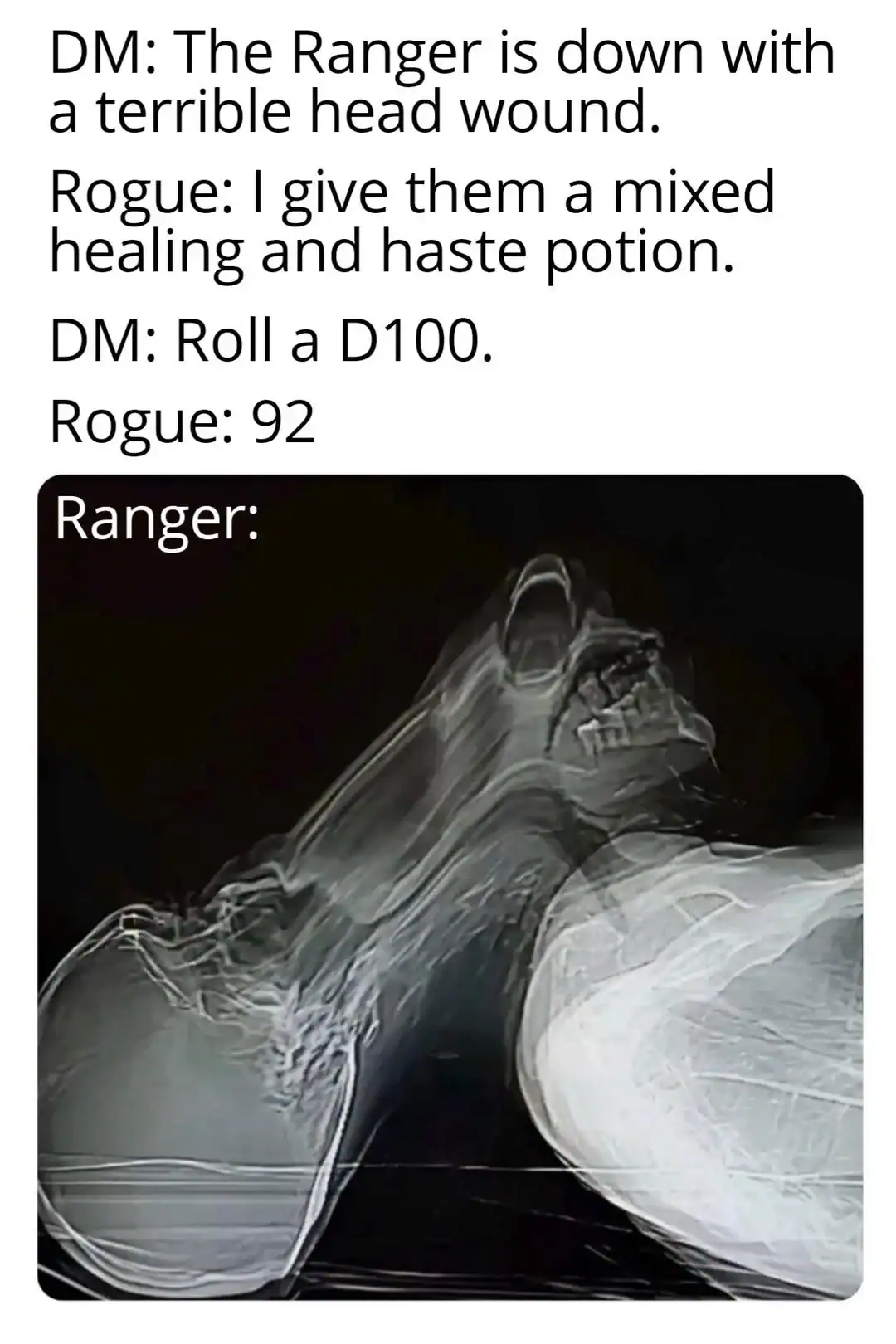 chaotic d&d meme depicting the aftermath of a Rogue giving a wounded Ranger a mixed healing and haste potion. After a high roll of 92, the result is shown as a terrifyingly distorted and vibrating X-ray skull, representing the intense magical side effects